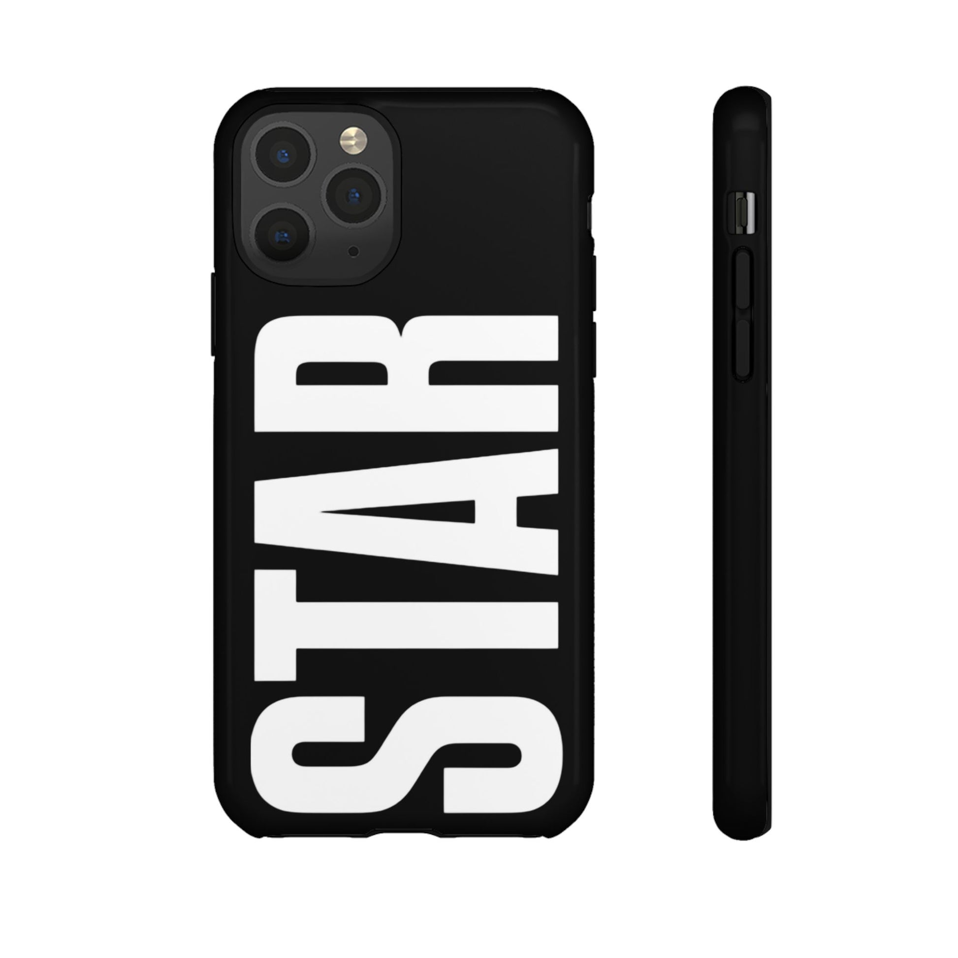 #STAR  case