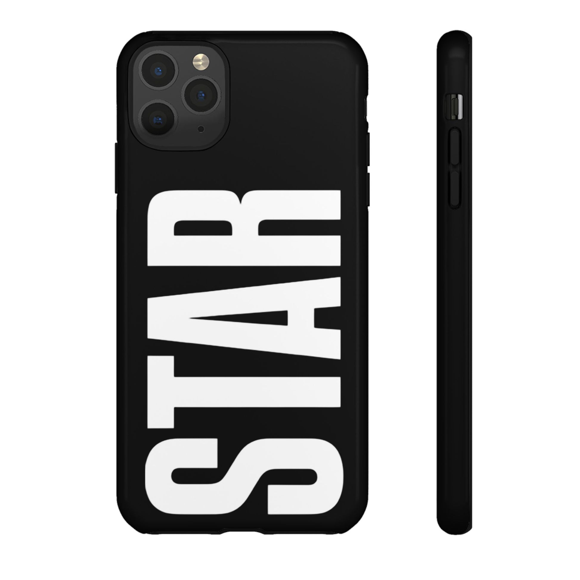 #STAR  case