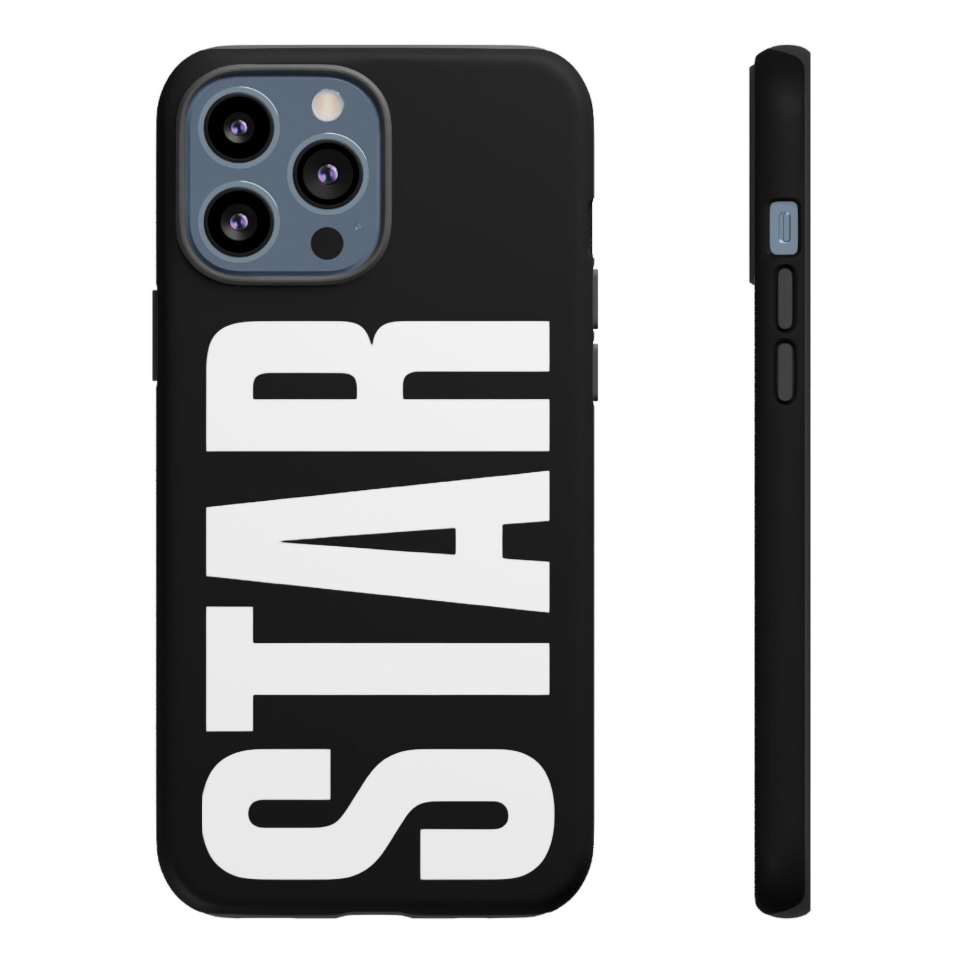 #STAR  case